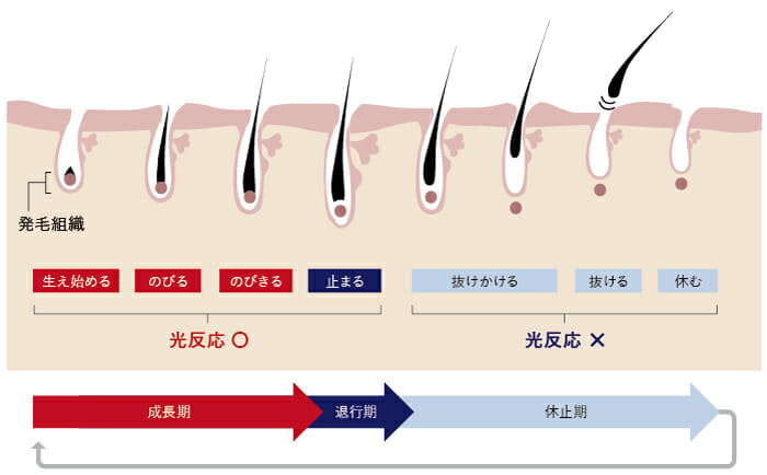 脱毛の毛周期について