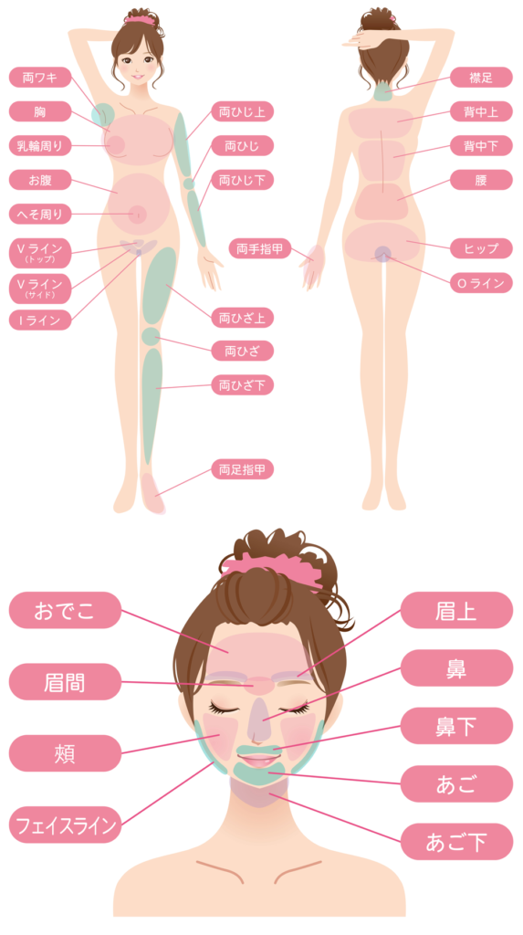 脱毛のパーツについて